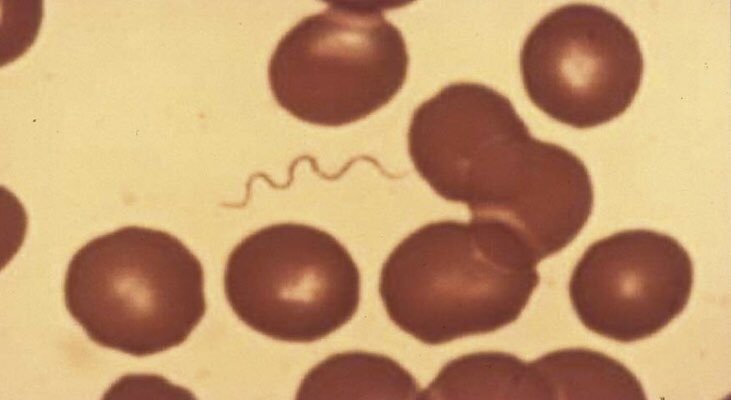 IUIDfellowship's tweet photo. #idboardreview 28 M returned 2 wks ago from cabin vacation CO: 1wk post return: fever, arthralgia x3d: felt better x1wk &amp; now again w/fever, fatigue, H/A, thrombocytopenia. Peripheral smear below. Diagnosis? #medEd #IdMedEd https://t.co/qJgOBkrshQ