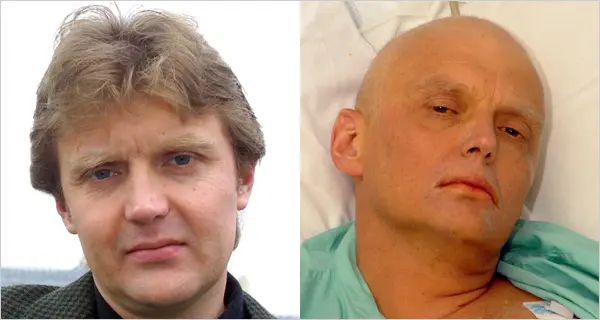 This is Alexander Litvinenko. He defected from Russia's main intelligence agency and fled to London where he wrote about the misdeeds of the Russian mafia state. Putin's thugs found him an poisoned him. He died.