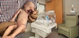 Delayed Cord Clamping in Preterm Resuscitation youtu.be/GwbL3vOIW-4