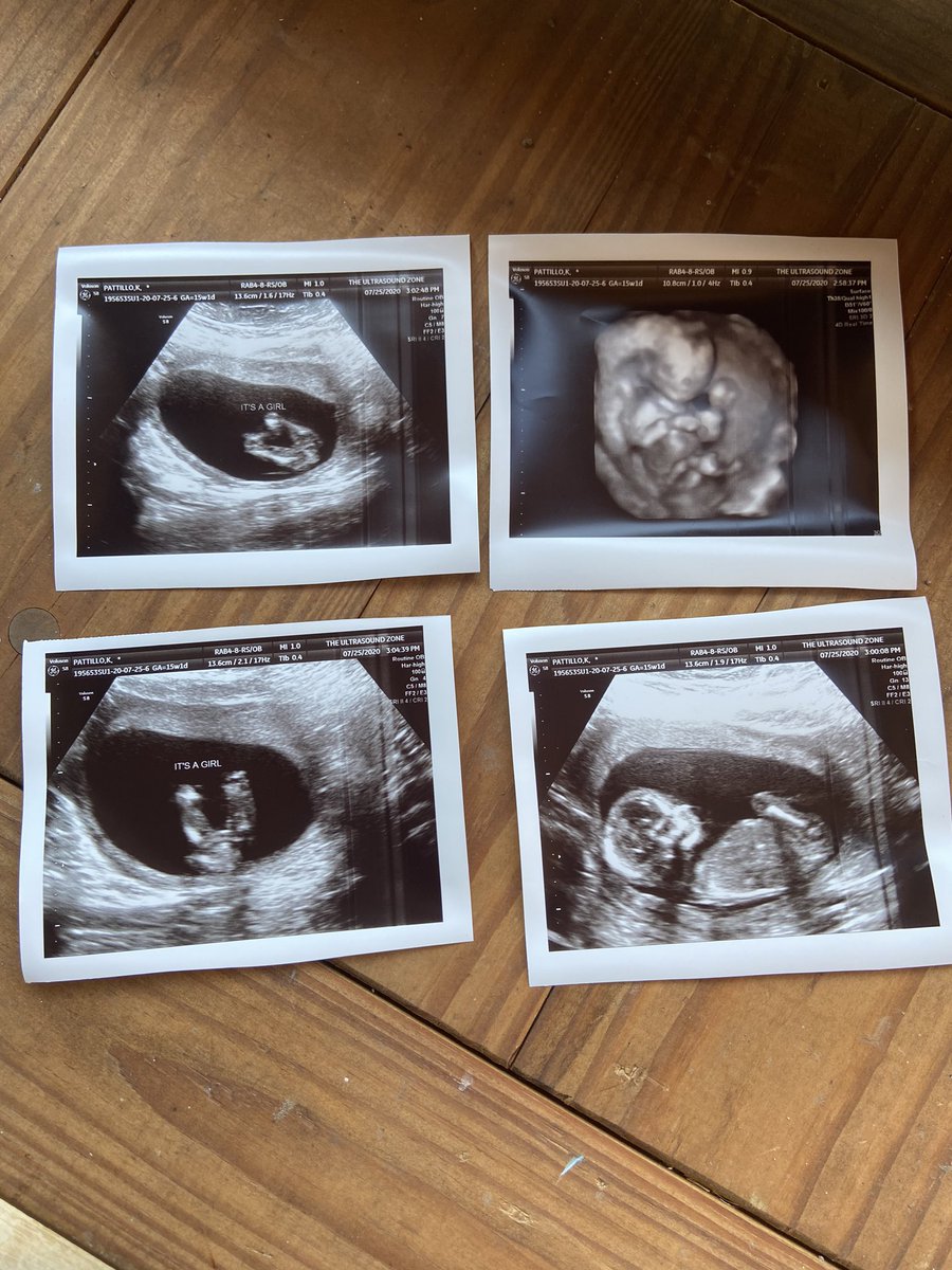 kcoch6's tweet photo. Baby Pattillo #2 is a GIRL! Can’t wait to meet my niece. #LaylaJane https://t.co/AtQrXm5Ds5