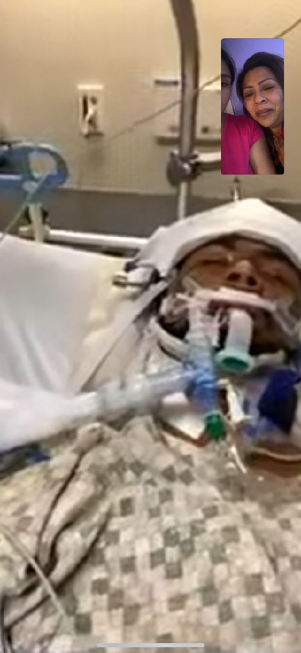 He suffered 5 pneumonias in total, he was left paralyzed neck down. He couldn’t breathe on his own he depended on a ventilator.He went through a series of surgeries, and was in intensive care for over a month after the arrest.