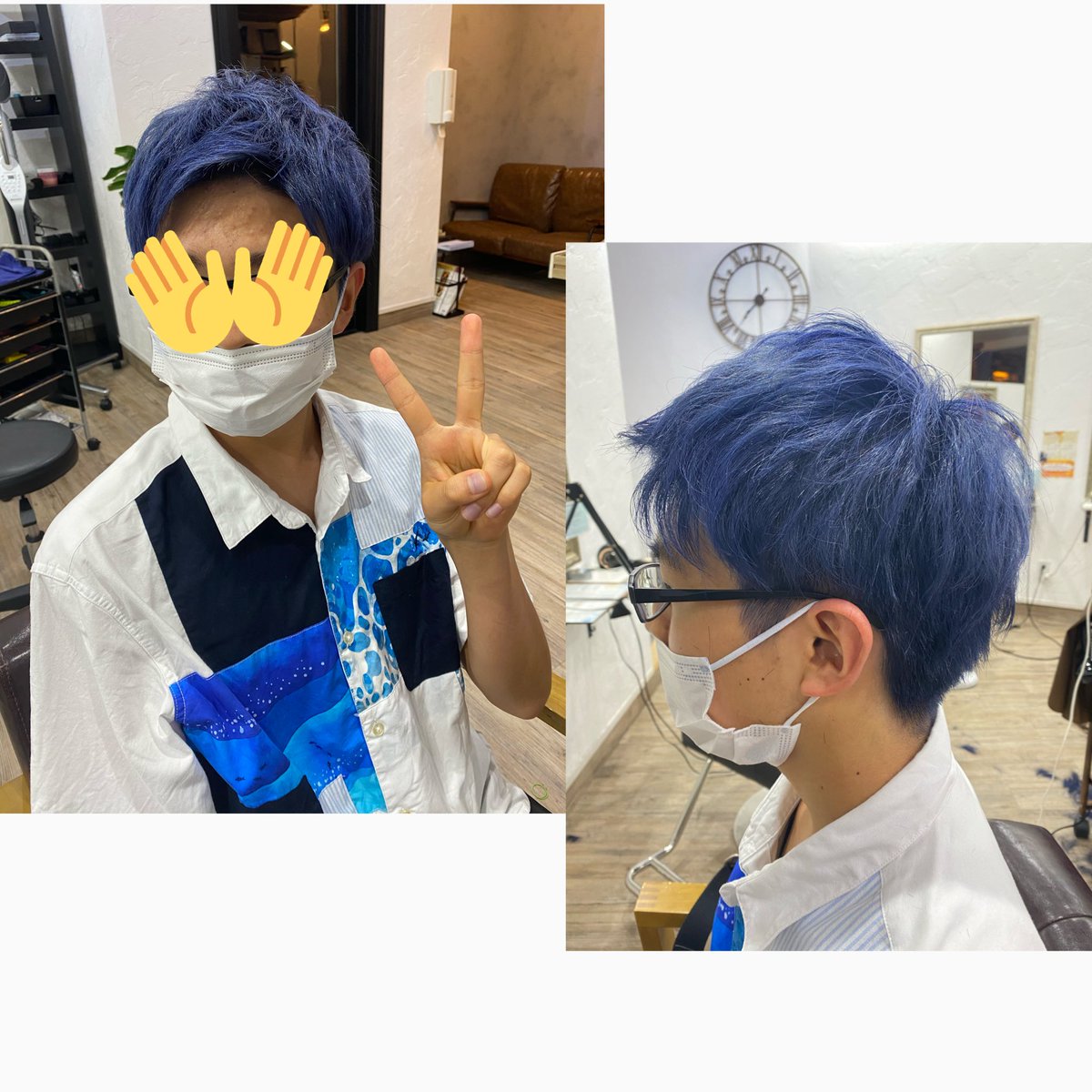 ハゲる