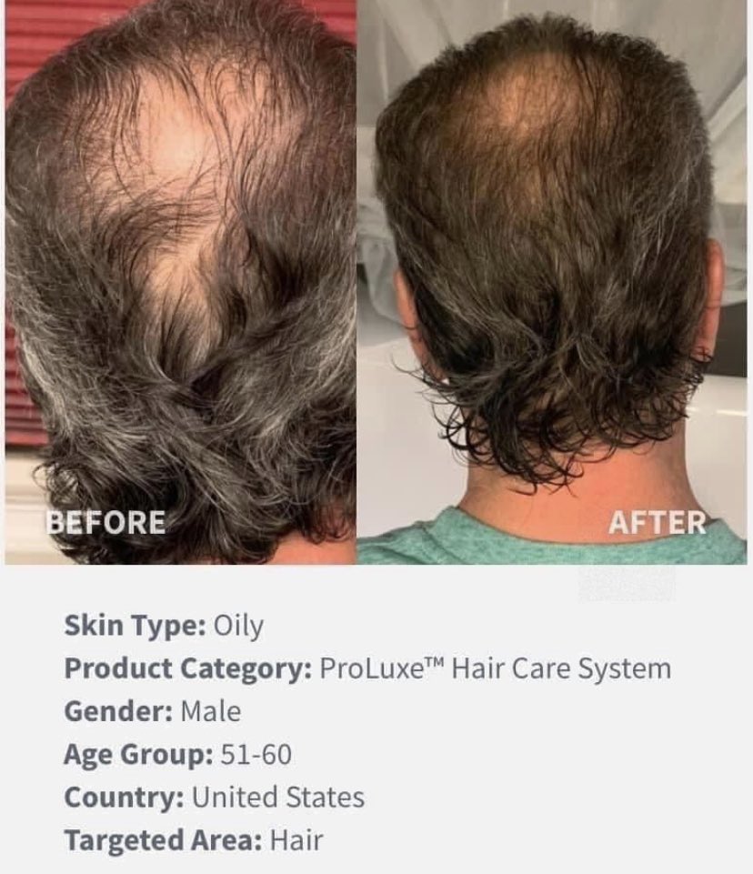 stephcha8's tweet photo. Well for the last year my hair has been changing and not for the better! It’s been thinner and frizzy. My good friend introduced me to these products and I am hooked!!!
Proluxe Haircare  System!!!

Message me for more details, I would love to help you
#neora #proluxe #gamechanger https://t.co/CKFRgJR3u2