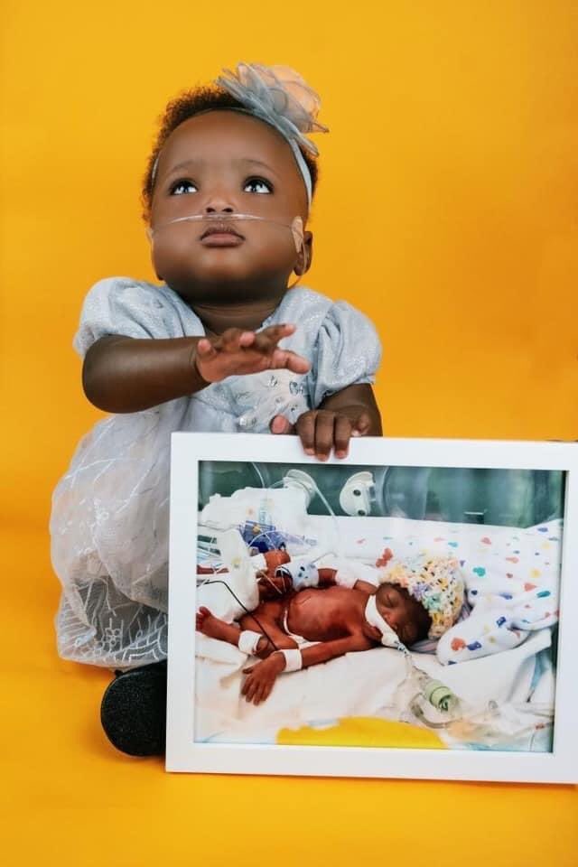 AMWK_22's tweet photo. I was born at 22 weeks, 1 pound 1 ounce, 11.5” inches long.  I wasn't given any chances of survival because the hospital policy does not resuscitate 22 weeks old. 
I’m now a year old today. 

Happy 1st birthday Ofe! 🎉

#AMomentWithKailor #22weeker

https://t.co/0SKdfnbtia https://t.co/tp2oBWylRU