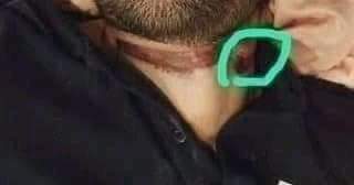 Why selective photos wr leaked. Who leaked the phtotgraphs. What message was police trying to sent. By selective leak was police trying to send message that  #SSR committed " Suicide" .Wr are the left,side and back neck photos.  @HMOIndia  #CBI