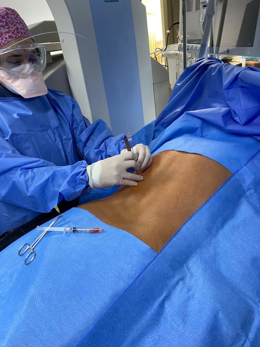 EIvanBravoC's tweet photo. Excellent surgery Dra. @ferchein! #PCLN upper calyx stone free! @LuisCaz86625685 @cristobalmd02 @erenhu_gonzalez @quetzalooo @chrisnaval13 @cristobalmd02 @leazanavi @dra_grisel_uro @DrGusHdez #UroHCM https://t.co/TeNhSRU7qX