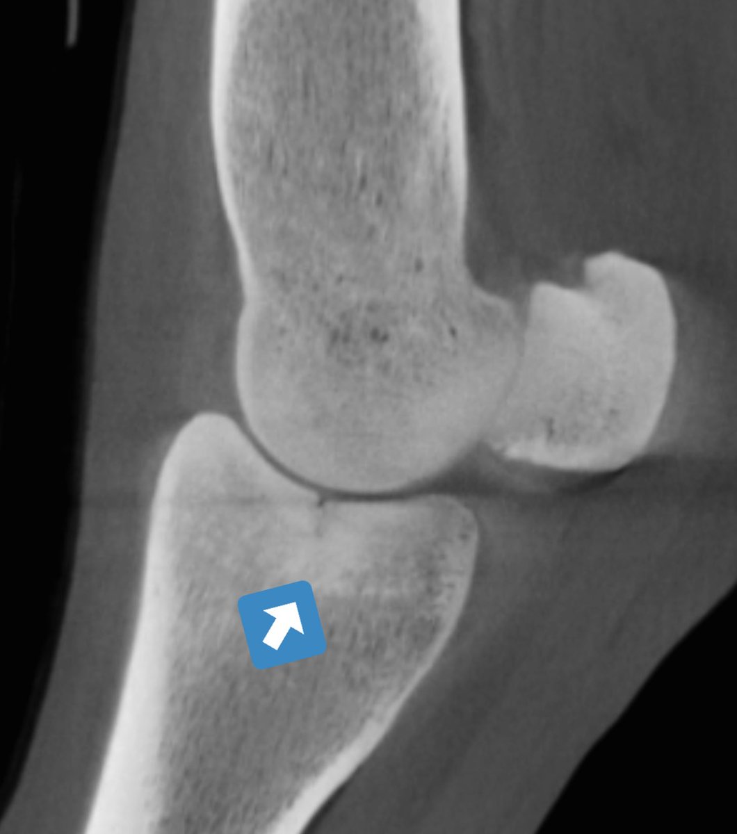 HoganEquine's tweet photo. Great example of preventative value of new imaging 👀 options used in collaboration in equine vet med-we sent this TB colt to @NewBoltonCenter for robot CT imaging and they found very rare early stress fx in pastern which we then repaired with single screw 🙌🏻#teamwork 🐎 https://t.co/Py8fi5iFzD