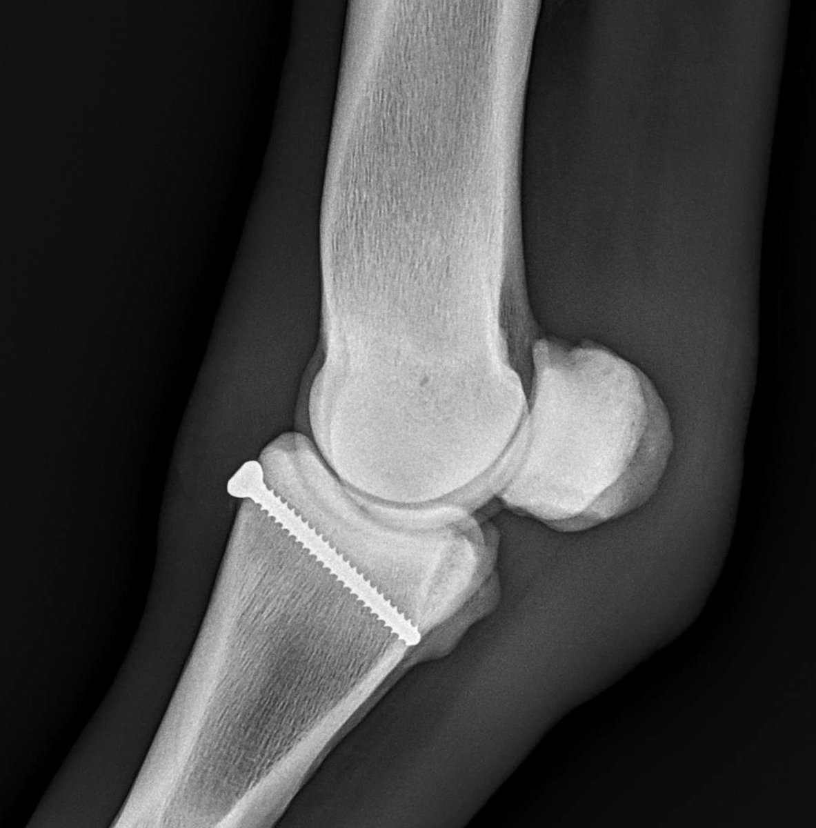 HoganEquine's tweet photo. Great example of preventative value of new imaging 👀 options used in collaboration in equine vet med-we sent this TB colt to @NewBoltonCenter for robot CT imaging and they found very rare early stress fx in pastern which we then repaired with single screw 🙌🏻#teamwork 🐎 https://t.co/Py8fi5iFzD