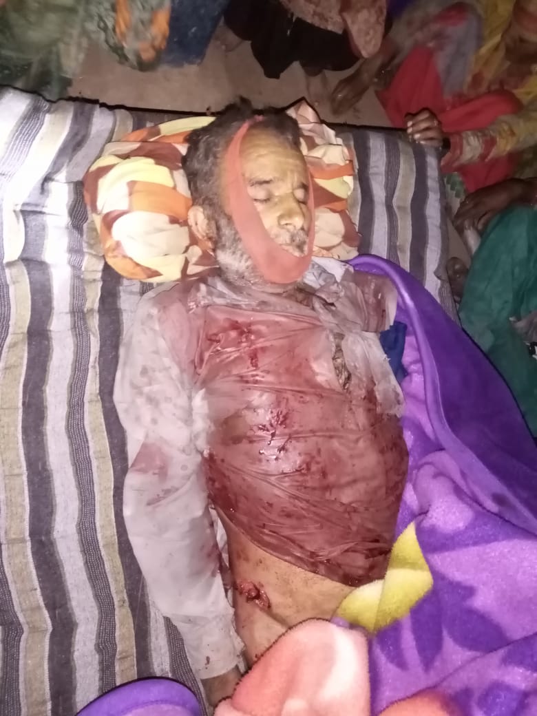 AkhtharShayia's tweet image. #BreakingNews  #LoCUpdate : میندھر سیکٹر میں پاک فوج کی بلا اشتعال فائرنگ کے نتیجے میں 60 سالہ محمد صدیق کی موت ہوگئی۔ پاک فوج کتنی بار معصوم شہریوں کو نشانہ بنائے گی؟
#CFV #sad #RIP @AlphaWo40963407 @LocUpdate