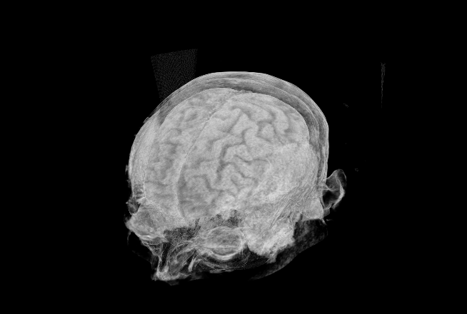 pymedix's tweet photo. Can you tell between an MRI and a CT? Tell us what you think! https://t.co/OGsDhuLhuC
#Pymedix #Autofuse #3Dimageregistration https://t.co/zznQ4Ec4VL