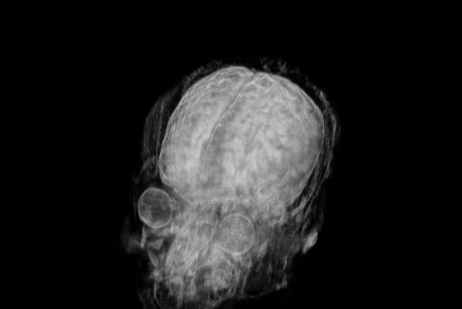 pymedix's tweet photo. Can you tell between an MRI and a CT? Tell us what you think! https://t.co/OGsDhuLhuC
#Pymedix #Autofuse #3Dimageregistration https://t.co/zznQ4Ec4VL