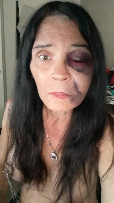 This is how I looked last night. https://t.co/E13t7sWg12<a href="/tag/apclips"class="tags"><span>#apclips</span></a>