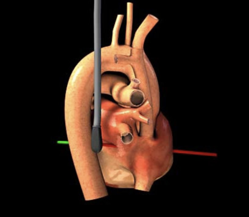 Resa E Lewiss MD (@resaelewissmd) on Twitter photo Resource for #TEE ultrasound education HT <a href="/PIEteam/">the PIE Group</a> <a href="/westernsono/">Western Sono</a> <a href="/arntfield/">Robert Arntfield</a> 👉🏽 pie.med.utoronto.ca/TEE/ Resource for #TEE ultrasound education HT <a href="/PIEteam/">the PIE Group</a> <a href="/westernsono/">Western Sono</a> <a href="/arntfield/">Robert Arntfield</a> 👉🏽 pie.med.utoronto.ca/TEE/