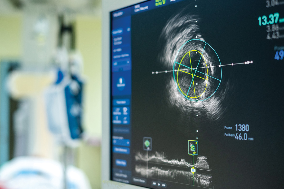 ACCinTouch's tweet photo. Dr. Ramya C. Mosarla and @EricSecemskyMD discuss the use of intravascular ultrasound for arterial and venous intervention in the latest issue of #CardiologyMag. Learn more: https://t.co/tWbER2OxW3 https://t.co/EBRcS0iqKy