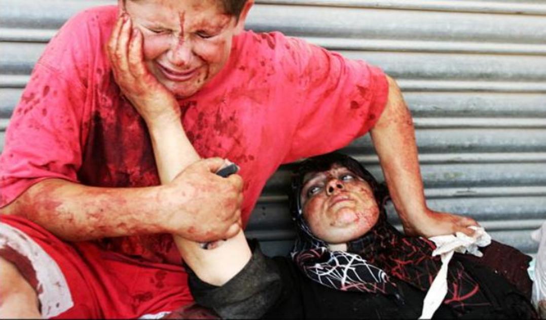 Lebanon, during the 2006 Hezbollah-Israel war.Look at each image. I have a surprise for you, so it's okay to look.A boy cries over his dying mother.