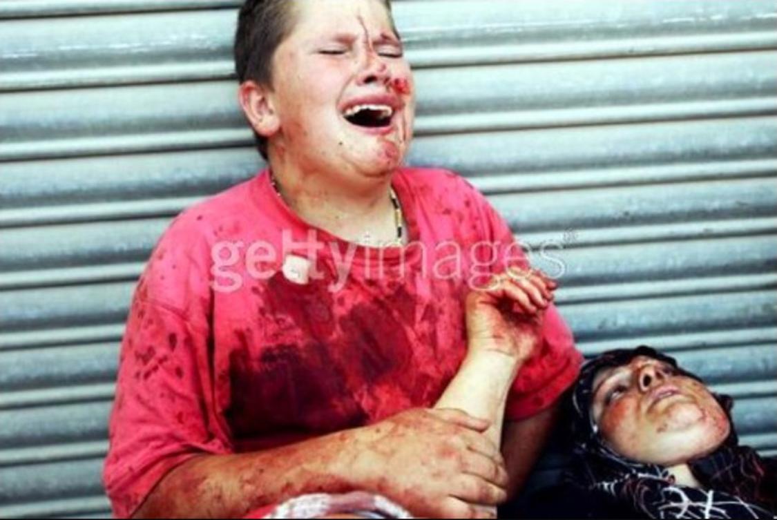 Lebanon, during the 2006 Hezbollah-Israel war.Look at each image. I have a surprise for you, so it's okay to look.A boy cries over his dying mother.