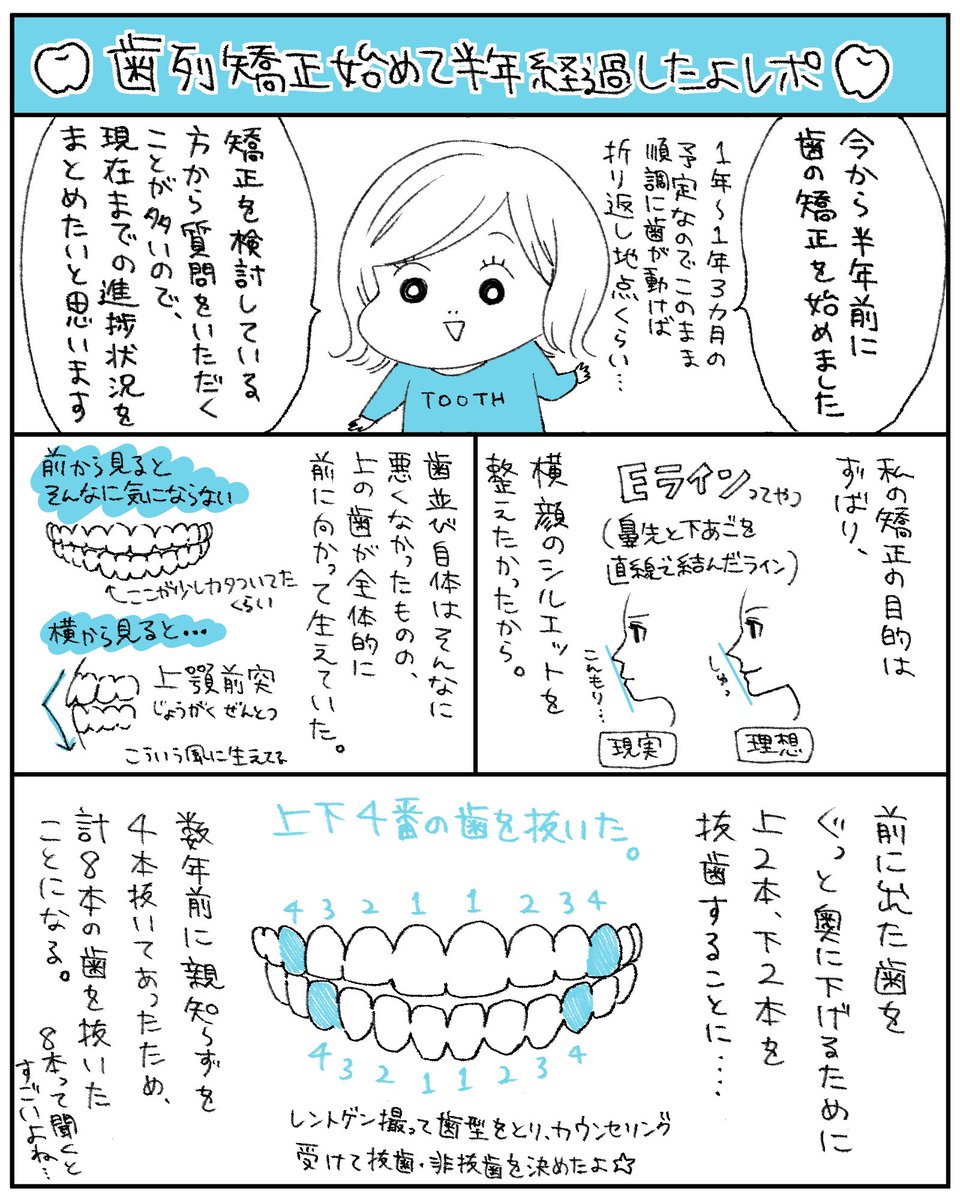 歯列矯正を始めて半年経ったよレポ(1/2)

歯列矯正のことをよく聞かれるので漫画にしました〜!まだちょうど折り返し地点ですが、まるで生き物のように順調に歯が動いてってます? 