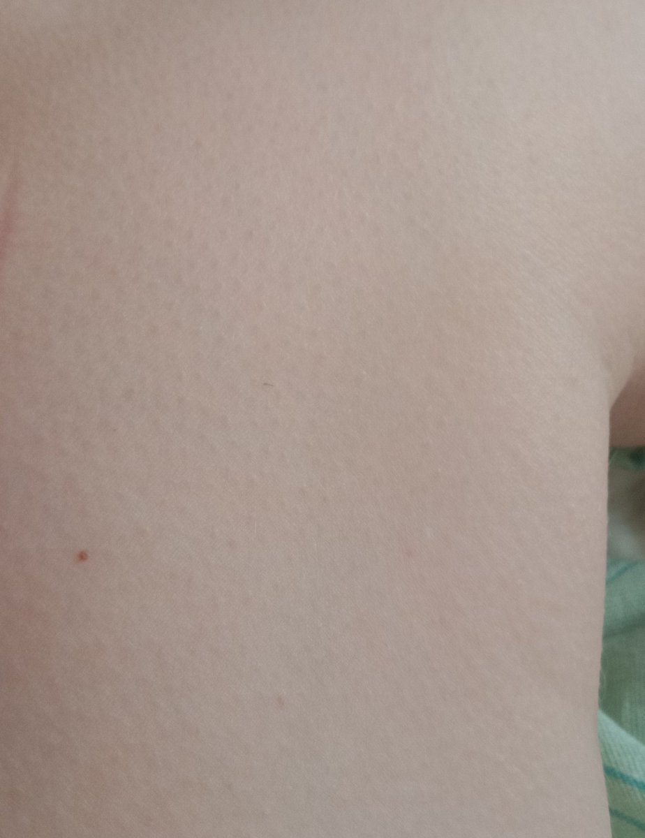 Да, моя нога, а что? 🗿💅👽