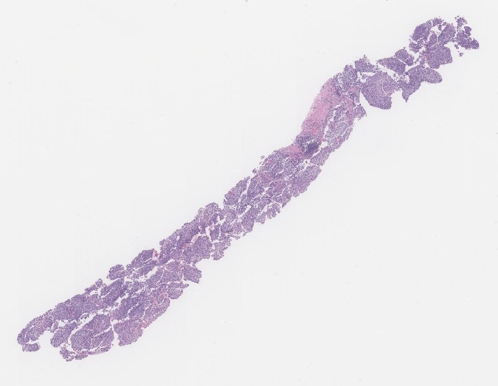 LiverPath_HPHS tweet picture