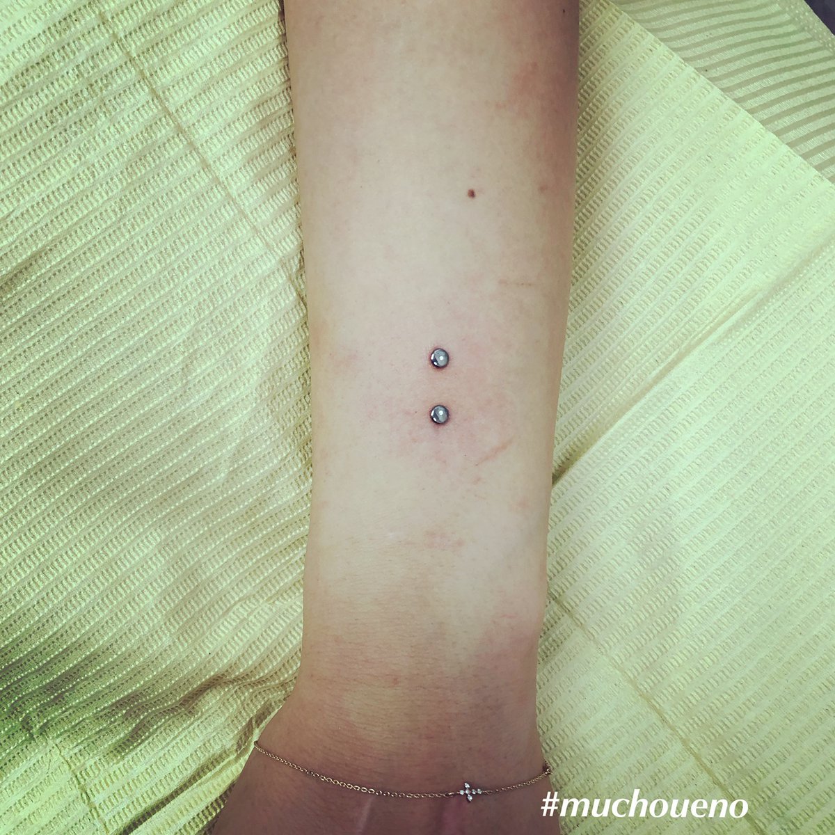 mucho_ueno's tweet photo. #ピアス #ピアッシング #ボディピアス #ボディジュエリー #ファッション #上野 #東京 #御徒町 #可愛い #腕ピアス #piercing #bodypiercing #pierced #fashion #tokyo #ueno #muchoueno #piercingintokyo #bodymodification #armpiercing #industrialpiercing #bodyjewelry #ピアッシングスタジオ https://t.co/zslOUTAsVo