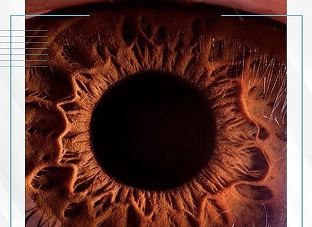 DraRubyE's tweet photo. El increíble y bello ojo humano ..#drarubye..#drarubyesperanza..#optom..#optometra.. https://t.co/hPIKjrmFOw