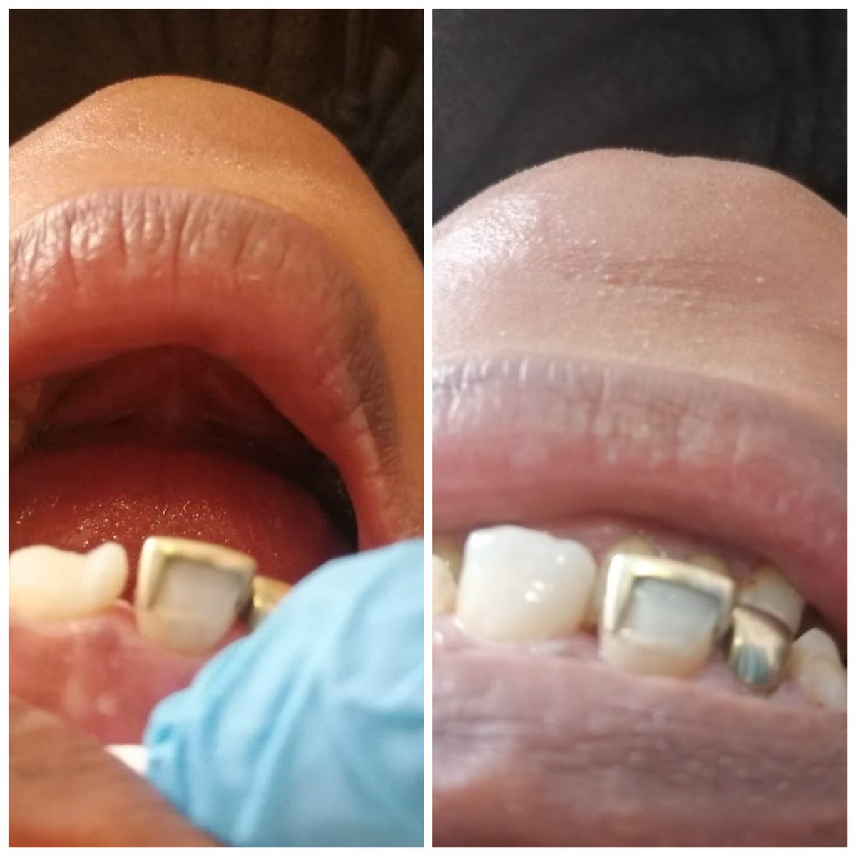 PrimesmileD's tweet photo. Primesmile dental the dentists that make a difference.. https://t.co/26dtKDXSjo