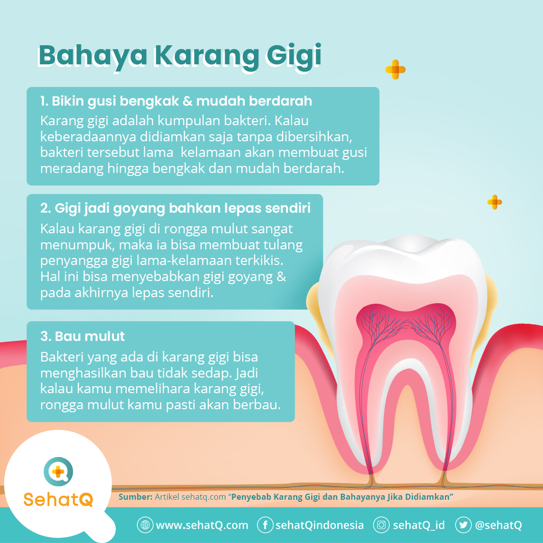 Sehatq Id A Twitter Idealnya Karang Gigi Dibersihkan Setidaknya Setiap 6 Bulan Sekali Ingat Untuk Membersihkan Karang Gigi Cara Yang Paling Efektif Adalah Dengan Scaling Gigi Di Dokter Gigi Https T Co 6duki0yyid Twitter