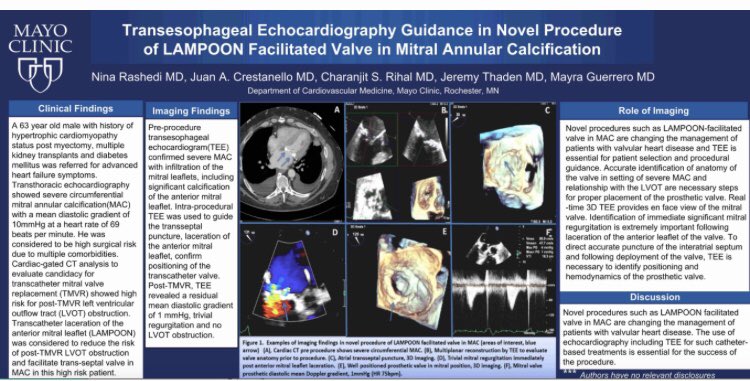 TEE Guidance in Novel Procedure of LAMPOON facilitated valve in MAC #ASE2020 @president’s circle <a href="/MayoClinicCV/">Mayo Clinic CV</a> <a href="/MayraGuerreroMD/">Mayra Guerrero, MD</a> <a href="/JeremyThaden/">Jeremy Thaden</a> #EchoFirst