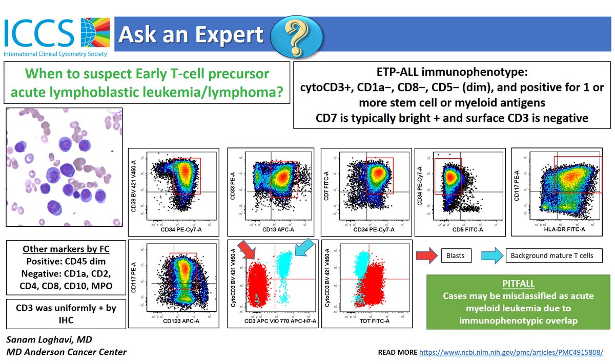 ICCS_Education's tweet image. Early T-cell precursor ALL shows immunophenotypic overlap with acute myeloid leukemia; distinction is critical. 👇 an example showing flow cytomteric features of ETP ALL. #FlowEdu #hemepath  #leusm 
Read more on ETP-ALL in this article  in @BloodJournal  bit.ly/3imYRz0