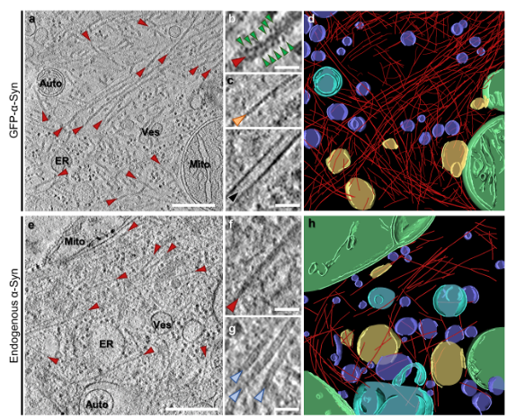 ScienceofPD's tweet photo. New @biorxivpreprint from @victoriatrinka1 @ruferbus & colleagues suggests that #Parkinsons-associated "neuronal α-synuclein inclusions contain α-synuclein fibrils intermixed with cellular membranes, & illuminate the mechanism of aggregate nucleation"
https://t.co/sKvM5VnIOO https://t.co/qwDJajJGsU
