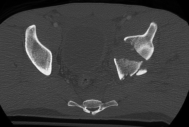 The axial dome image