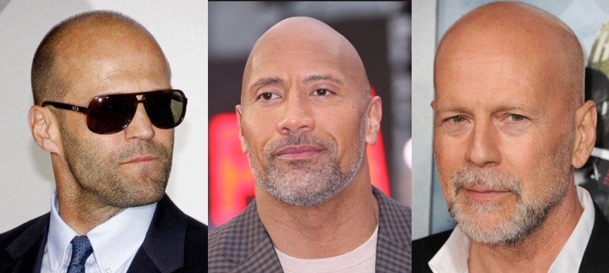 "But Manny I'm bald. What can I do?"Nothing. All good though. Just shave your head (or crop it real close). Grow out a beard/stubble to add some contrast to your face.