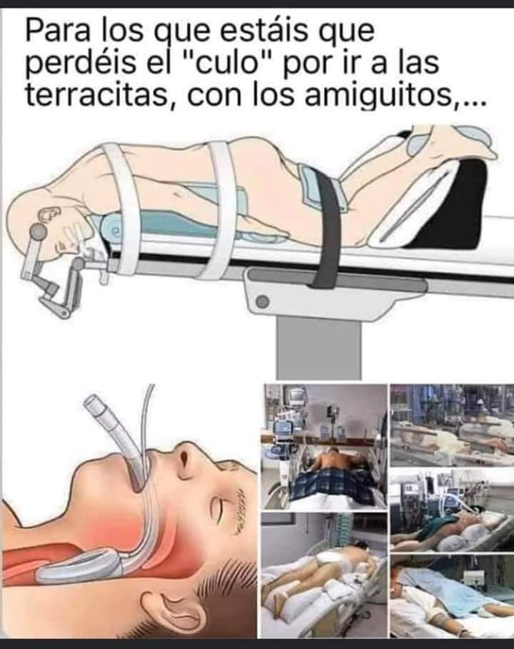 Xabi196420's tweet image. Hoy hemos atendido un paciente Covid19,saturando a 80 de O2 con reservorio, de 40 años,si, 40. La Radiografía de sus pulmones parecía un árbol pero de Navidad de lo blanco que se veía. Seguir haciendo el tonto con las mascarillas y la distancia social,seguir...