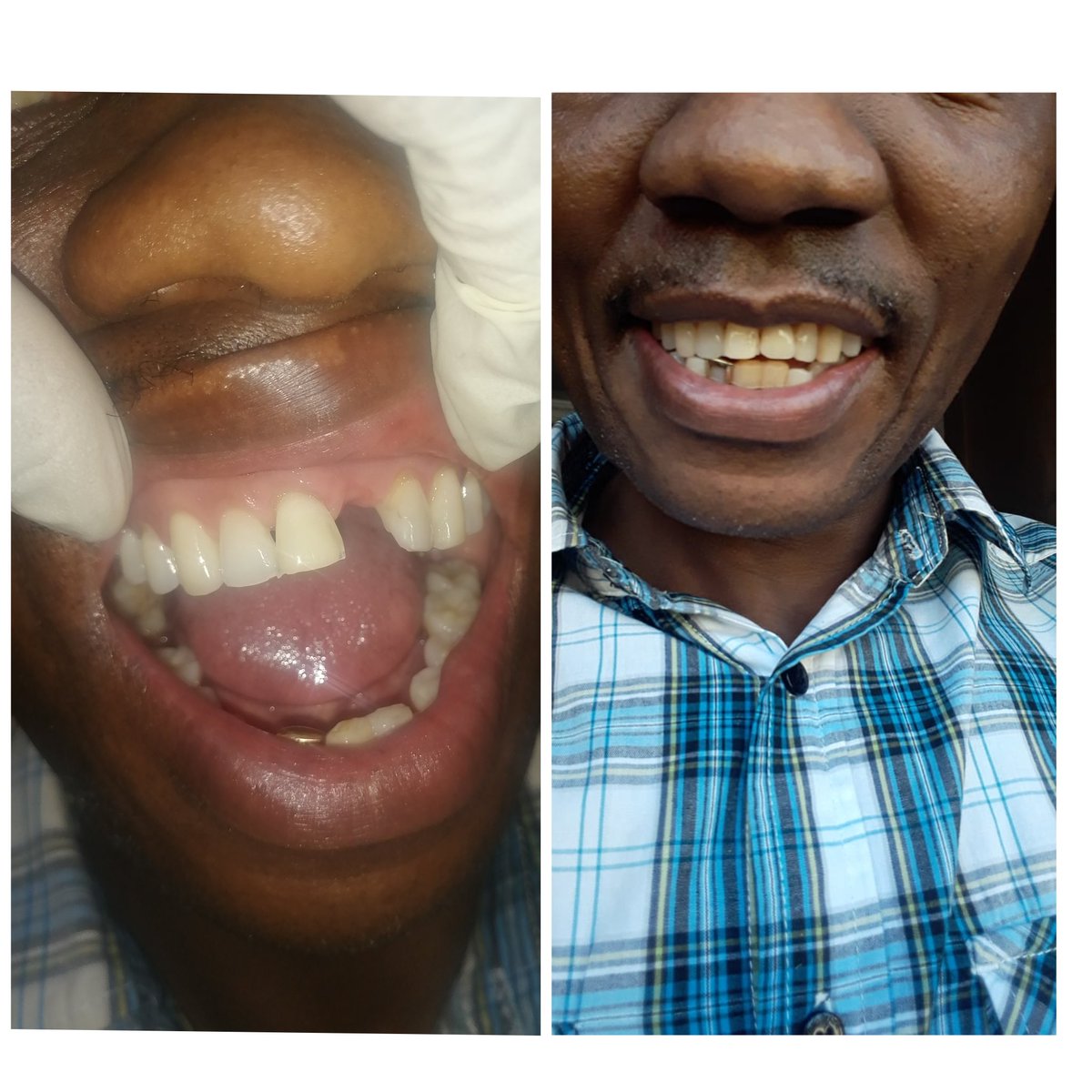 PrimesmileD's tweet photo. @danielmarven We change smiles... https://t.co/Zwot2Kjh9M