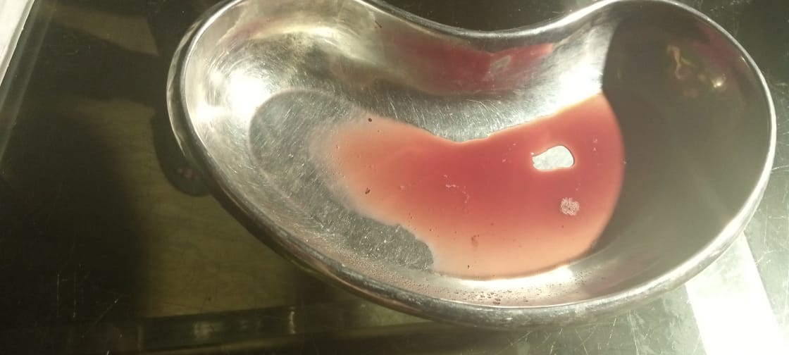 it was claimed this was semen, without any sort of lab test. There was another picture which she claimed was a mixture of semen and blood. As someone who has a cat and has been going to vets since childhood, even I know what this is; post infection serum, a clear sign of abscess.