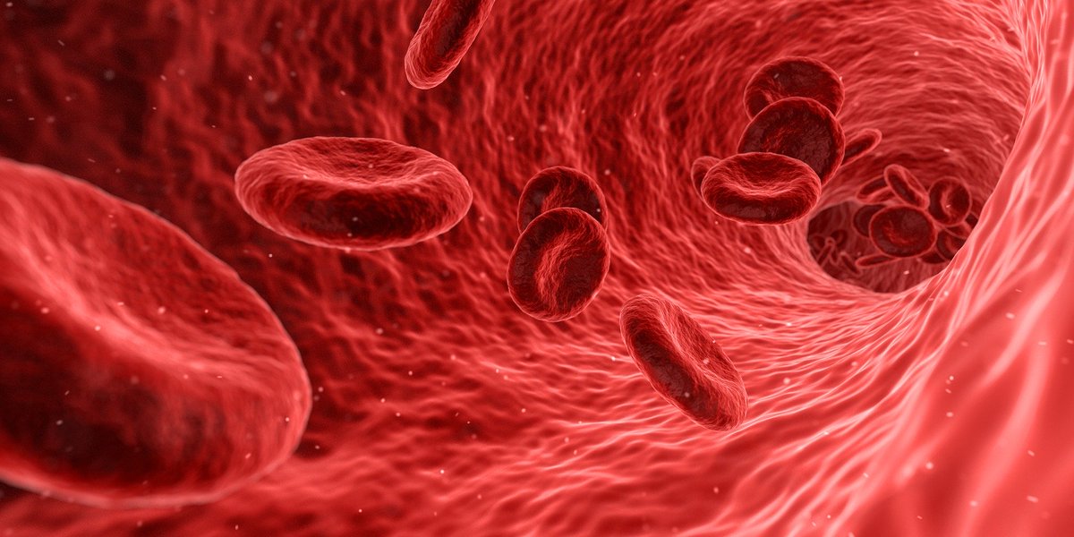 Exeter Med School (@exetermed) on Twitter photo 1/3 New #research <a href="/UniOfExeter/">University of Exeter</a> shows a high blood platelet count could indicate a high risk for #cancer, specifically in men 60+. Blood platelets help the blood to clot properly. Led by @sSarahBailey
exeter.ac.uk/news/research/… 1/3 New #research <a href="/UniOfExeter/">University of Exeter</a> shows a high blood platelet count could indicate a high risk for #cancer, specifically in men 60+. Blood platelets help the blood to clot properly. Led by @sSarahBailey
exeter.ac.uk/news/research/…