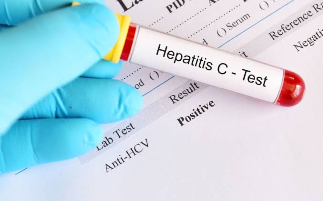 Тест на донора крови. Вирус Hepatitis c. Hepatit c исследование антител. Тест на гепатит с.