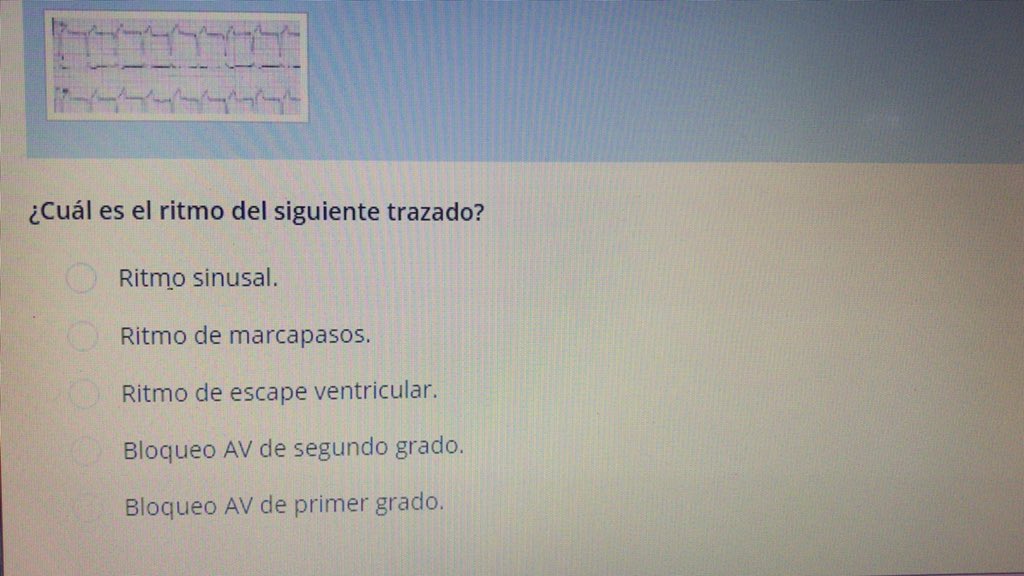 Hola buenas tardes, necesito ayuda con unas actividades de electrocardiografia!!