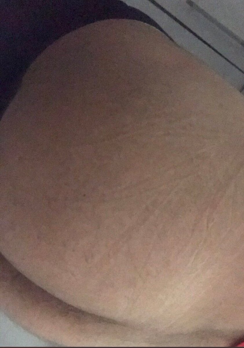 Pasifffazgin's tweet photo. Beni catir catir sikecek buyuk aletli aktiff yok mu 😋 https://t.co/UGJcae7agP