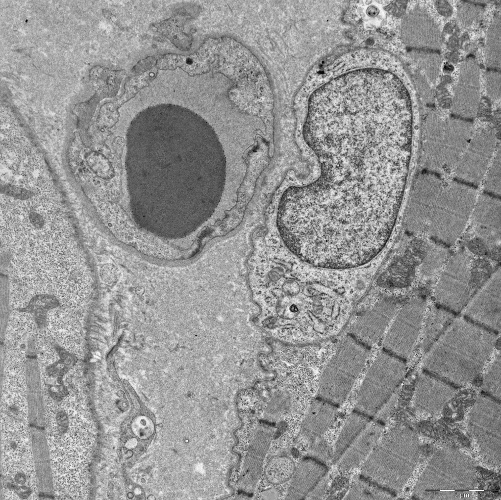 This one is for you <a href="/BenChazaud/">Ben Chazaud</a> - I don't think this satellite cell could get any closer to this capillary!