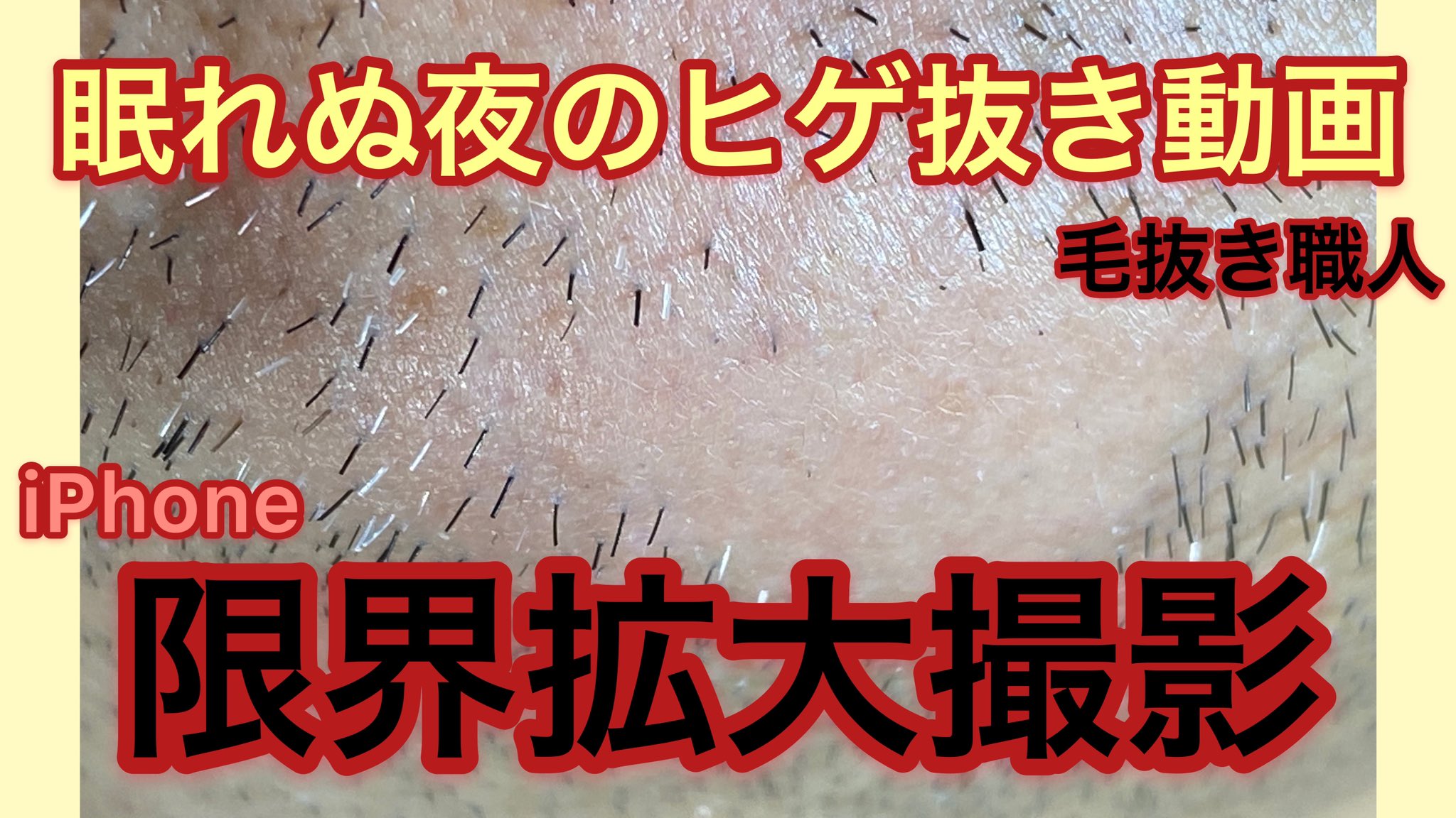 毛抜き職人 Hair Removal Specialist 眠れぬ夜のヒゲ抜き動画 Plucking Facial Hair ずっと見ていられる拡大のヒゲ抜き 7 31 アゴ髭白髪多数 P T Co Ievn0vzu3k Youtubeより今回は白髪ヒゲも毛根鞘も多く ピントもバッチリの