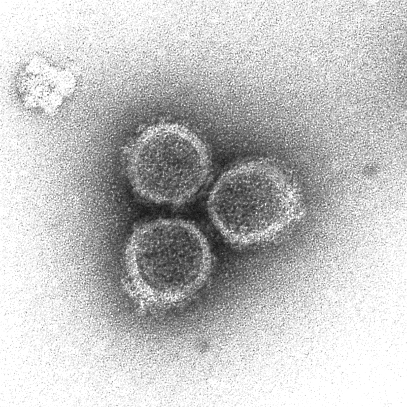 RiscoLab's tweet photo. Conoce a Cristina. Jefa, guía espiritual del #CellStructureLab y experta microscopista.
Con años de experiencia en el estudio de la interacción virus-hospedador, ahora aplica ese conocimiento al estudio de la infección de #reovirus,
#bunyavirus y #coronavirus en células humanas https://t.co/bTL9hVkEzc