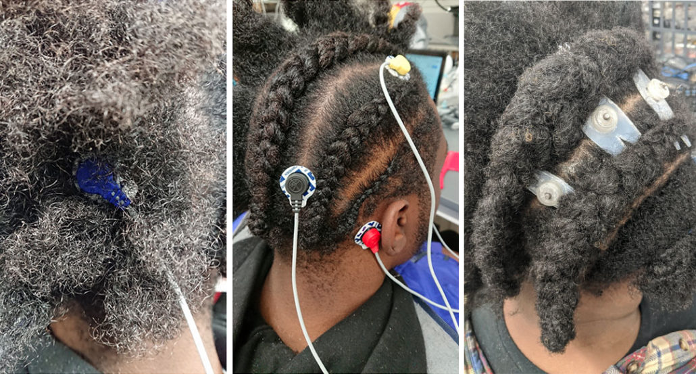 EEG electrodes need to be close to the skin to get the brain's electrical signal. With normal electrodes on curly & coarse hair, this can be challenging.Arnelle Etienne and a group of researchers ( @CMUGroverLab) recently changed that, by developing a whole new technique.