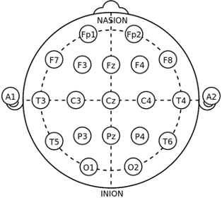 Given all that we talked about today, is it really surprising that there is distrust by minorities surrounding research participation? Even more, in some cases, the technology developed is itself not-inclusive: for instance EEG electrodes.
