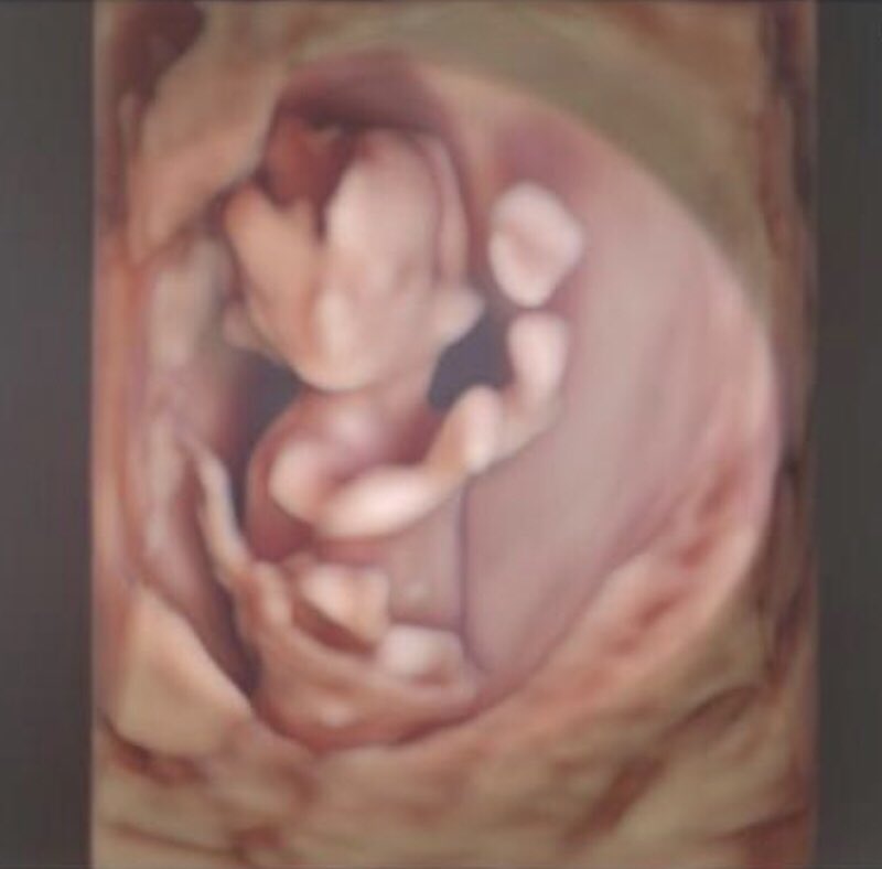 Cuando Lucía tenía 10 semanas de gestación. A esta edad ya escuchábamos latir su corazón, misma edad en la que matarla era legal en CDMX y muchísimos lugares más. ¡No a la despenalización del aborto en México!

#mexicoesprovida
#corteabortono