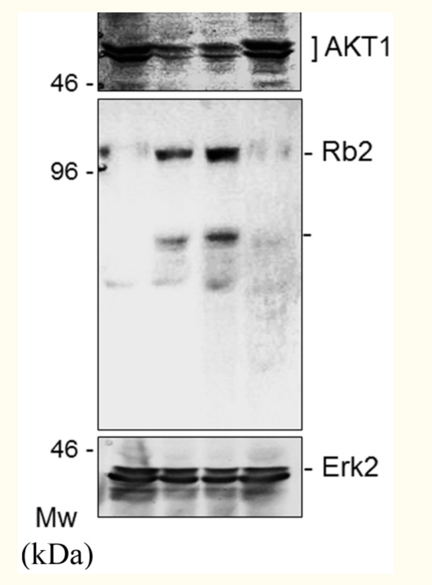 It showed that terpinolene was effective in reducing ATK. 2nd lane is rosemary, 3rd is sage, 4th is green tea. The first lane was not treated and shows much more presence of ATK!  https://www.ncbi.nlm.nih.gov/pmc/articles/PMC3362481/