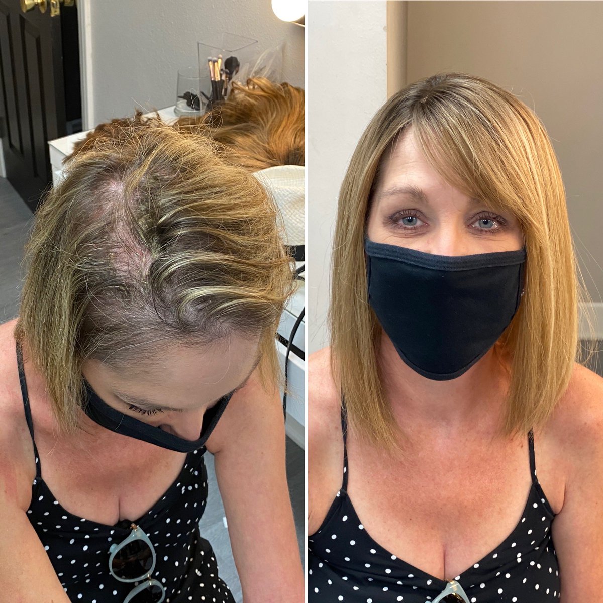 BEFORE &amp; AFTER #HairTransformation 😍 #MilanoBabe #milanowigs in Topaz Topper! Head to our IG stories for full story! #wigs #topper #toppers #wiglife #hairtransformation