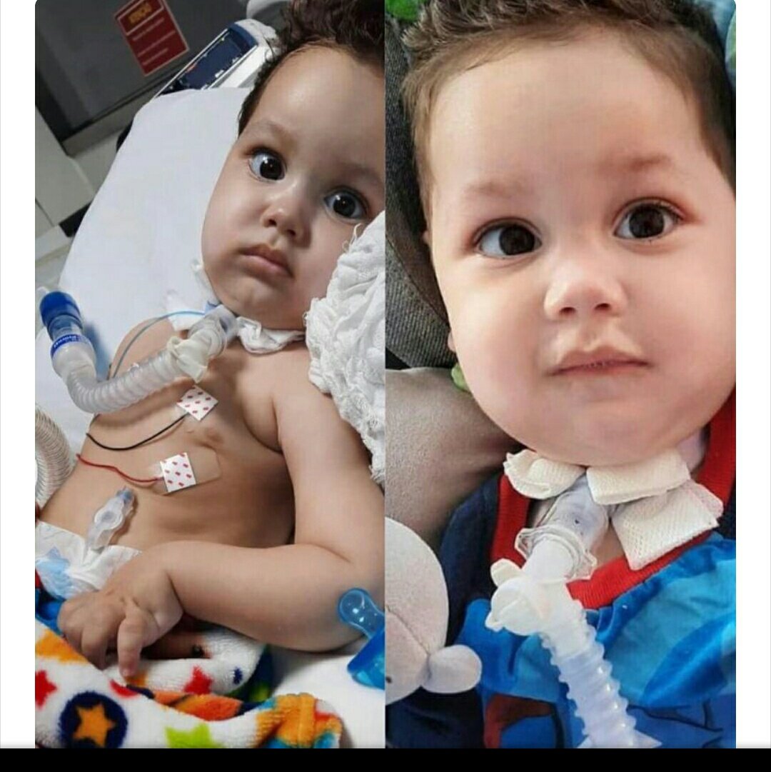 Isalace25422618's tweet photo. Desculpe me envolver no movimento de vocês. + eu peço a atenção de vocês para algo muito sério. Um bebê de 1 ano e 8 meses ,tem uma doença rara, que em alguns casos leva o bb a óbito, AME tipo 1 a+ grave. Nós ajude a salva lo?https://t.co/xf9Zjdmyly
#NaturaNao 
#NaoCompreNatura https://t.co/d6YtEM26b4