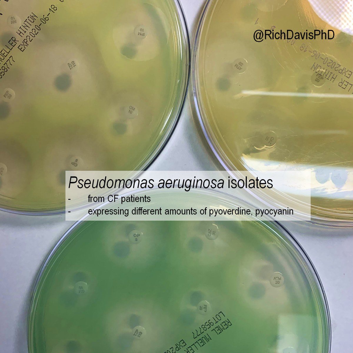 richdavisphd's tweet photo. #MicroRounds (Day 700): Color wheels.

For a big round number (700 of these #MicroRound posts!) a clinical microbiology staple:

Three diff isolates of Pseudomonas aeruginosa producing different amounts/shades of pigmented pyoverdine and pyocyanin. 

#ASMClinMicro #IDTwitter https://t.co/eCzgSNTNOc