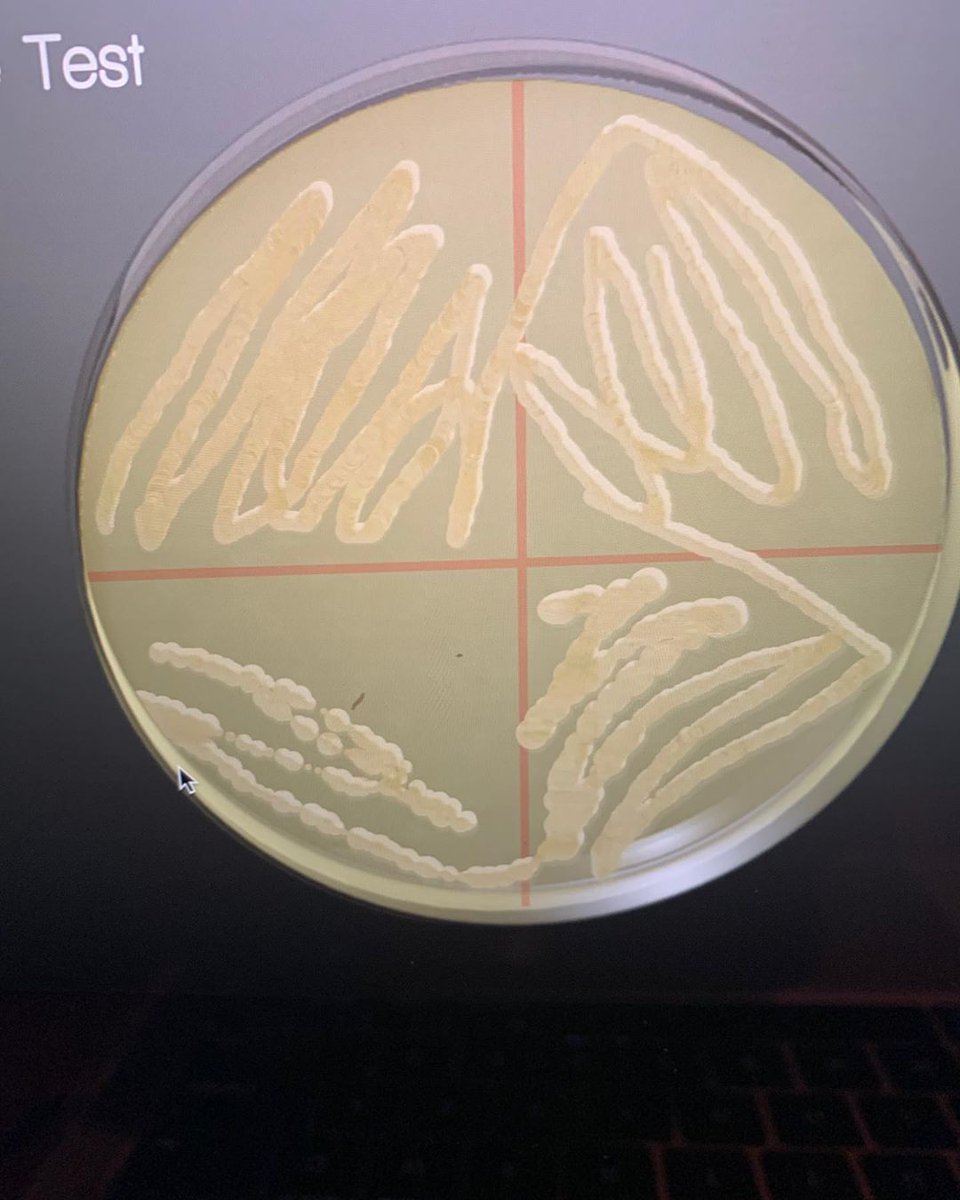First2Network's tweet photo. Our virtual Summer Immersion students from the @marshallu campus are preparing streak plates and viewing various things through their microscope!
π¦ π¬
#firstgen #stem #first2network #microbiology #Biology #Science #EducationForAll #westvirginia #STEMeducation #scienceathome https://t.co/QoFF50WF6U